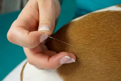 Services Acupuncture